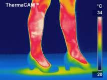 6. El confort térmico del calzado así como en la prevención de lesiones puede ser valorada mediante termografía infarroja.