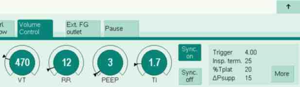 En combinación con el sistema de monitorización de pacientes Infinity Acute Care System (IACS), Perseus A500 puede contribuir enormemente a los resultados del paciente y a la optimización del flujo