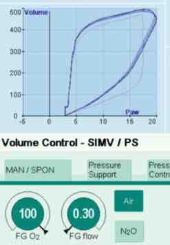 0 también incluye ahora modos de ventilación adicionales: Control sincronizado de volumen (VC-SIMV), sin (opción estándar) y con (opcional) respiraciones intermedias mediante presión de soporte