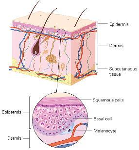 CARCINOMA BASOCELULAR: INTRODUCCIÓN Cáncer de piel más frecuente.