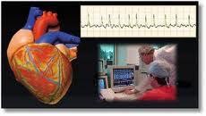 Cardiopatía isquémica y