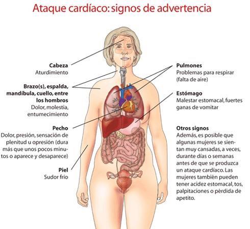 Enfermedad Cardiovascular Las enfermedades cardiovasculares son un grupo de trastornos del corazón y los vasos sanguíneos y es la primera causa de muerte a nivel mundial.
