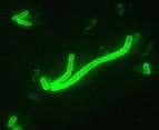 (Lombríz del cuajo) Bacilo fluorescente. Wilkipedia (F.