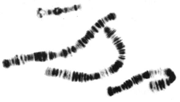 8.7 Els cromosomes: Forma i