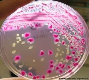 Enterobacteriaceae en la microbiota intestinal de los humanos y los