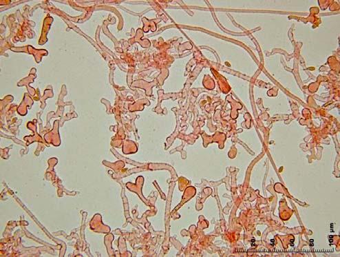 5. Pileipellis himenodérmica, de células clavadas a