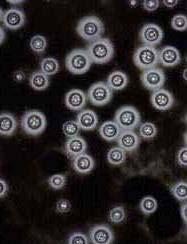 Cryptococcus neoformans Susceptibilidad in vitro n= 332 CIM, M27-A2 CLSI modificado Rango CIM 50 % Resistencia