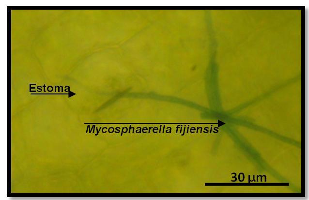79 FIGURA 3.12 ESTOMA PENETRADO. Se observa la presencia de la estructura del hogo Mycosphaerella fijiensis, y como esta ingresa a través del estoma de la hoja 3.