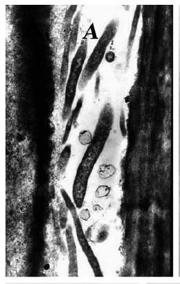 Tres especies bacterianas asociadas Bacterias Gram-negativas no cultivables Viven en los tubos cribosos del floema de los