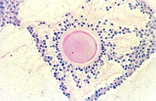 El Ovocito II Más grande que el espermatozoide No 9ene movilidad propia Tiene reservas nutri9vas