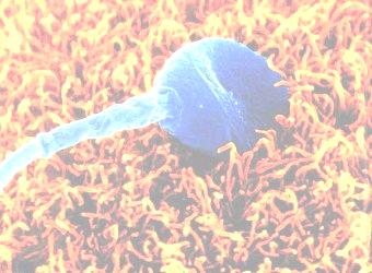 Espermatozoide Cabeza: núcleo con una delgada capa de citoplasma que lo rodea.