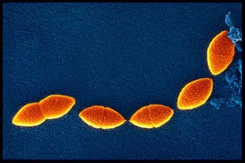 Edad y causas de NAC Neumococos Principal bacteria productora de NAC típica y de formas
