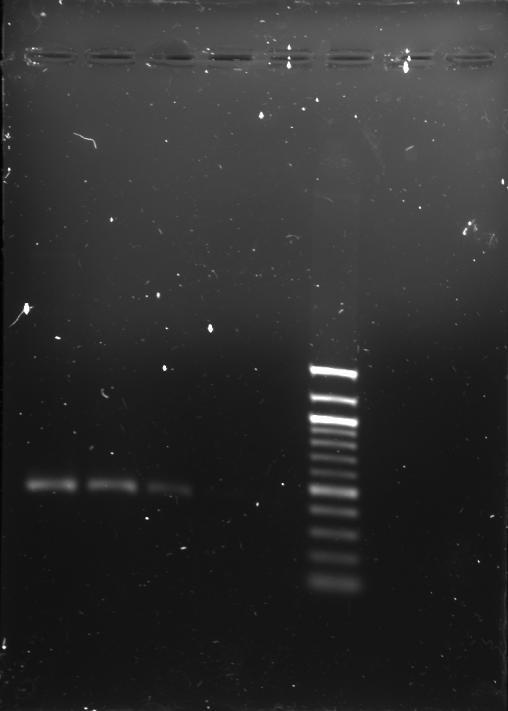 I PCR de las tres clonas obtenidas a dos concentraciones diferentes; A1, B1 y C1 están a 1ng/µl y A2,
