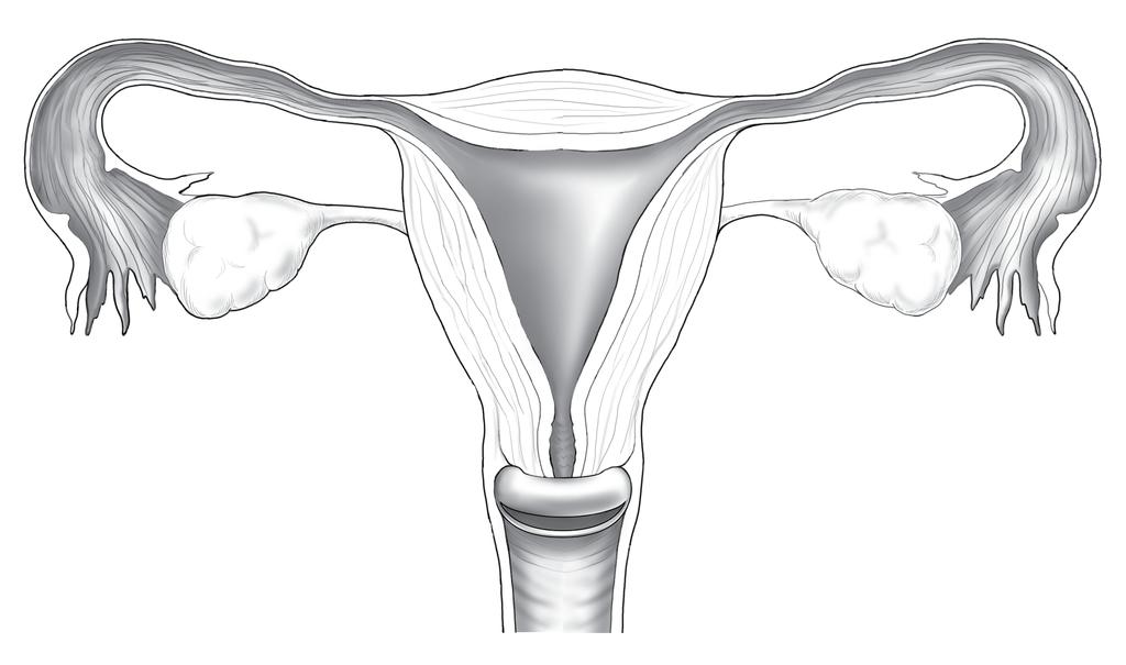 infecciones de transmisión sexual es usar un condón junto con otro método, como un espermicida. El espermicida se debe colocar dentro de la vagina, no en el condón.