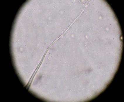 ) se observa la región anterior achatada, células intestinales (triangular) y cola redondeada (vaina corta)./ Trichostrongylus sp.