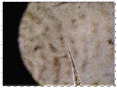 Género Ostertagia: En la observación microscópica, la L3 de este género se presenta morfológicamente de forma fina y larga, distinguiéndose