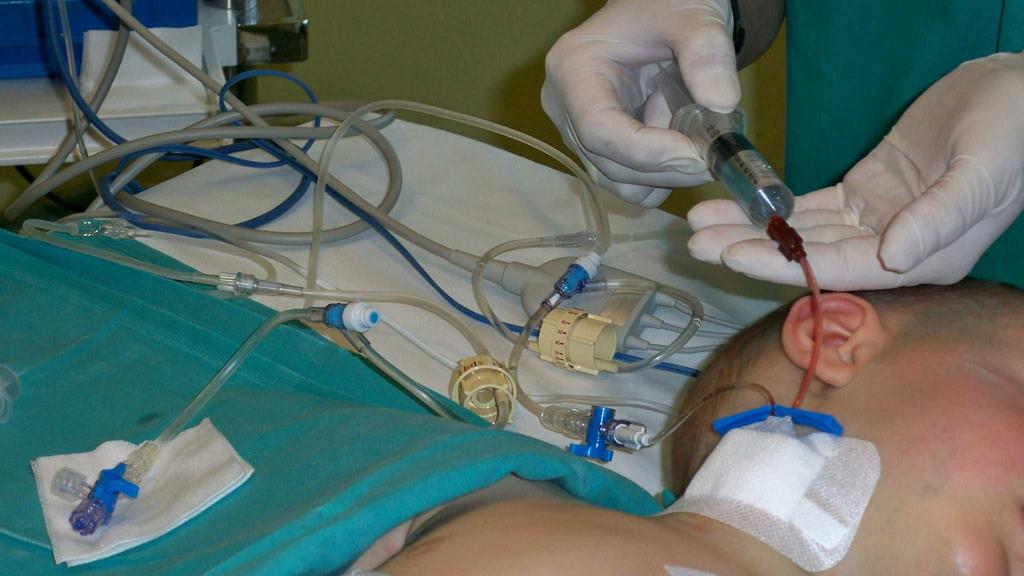 Extracción de sangre Conectar una jeringa de 10 ml a la conexión. Soltar la pinza de clampado Extraer lentamente una cantidad de sangre en función del catéter Cerrar la pinza de clampado.