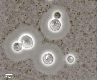 Forma sexual R.asexual: Cryptococcus neoformans Var.