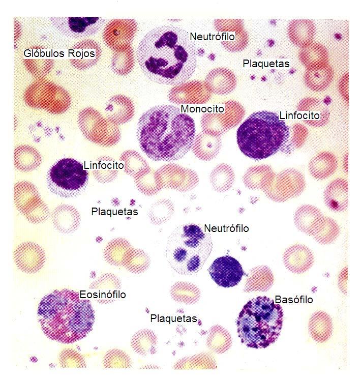 Sangre periférica que muestra las diferencias de forma y color de las formas principales de Leucocitos: Los neutrófilos