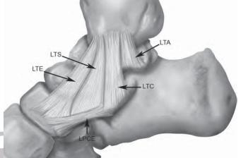 Ligamento lateral externo.