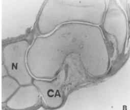 El ligamento interóseo astrágalo-calcáneo en el seno del tarso estaba formado por filamentos delgados de fibras de colágeno que estaban casi desprovistas de células.