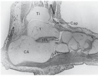 La tuberosidad medial era grande y muy cercana al maléolo medial, presentando un área amplia para la inserción del ensanchado tendón del tibial posterior.