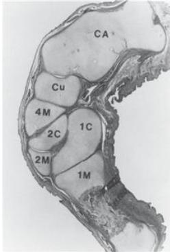 En el pie equino varo (Fig. 29A), el corte pasa a través del astrágalo (T) y el calcáneo (CA), pero en el pie normal (Fig. 29C) el corte pasa a través del astrágalo y por arriba del calcáneo.