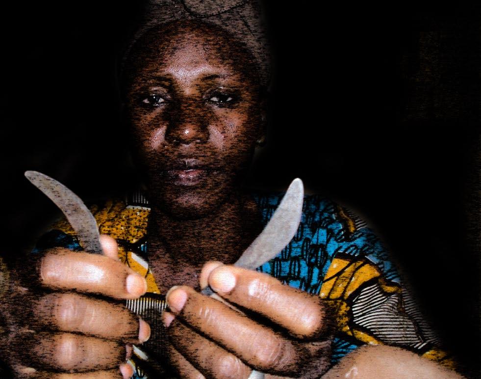 Mutilación Genital Femenina Esta mujer de la Asociación Contra la Mutilación Genital Femenida de Mali nos muestra las cuchillas utilizadas en estas prácitcas.