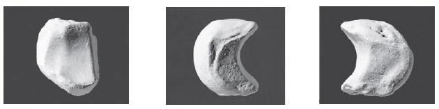 07 Vista del Hueso Escafoides Derecho Fuente: The Human Bone Manual. (White, T. y Folkens, P., Op. Cit., p.229). Hueso Semilunar: Tiene la forma de media luna.