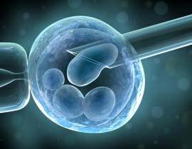 TRANSFERENCIA DE HUSO Transferencia el material nuclear genético El huso con cromosomas maternos de un ovocito se transfiere a otro ovocito al que