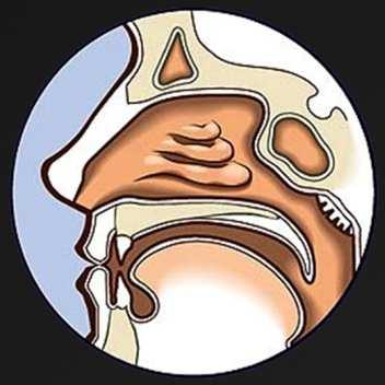 Mucosa Swallowed