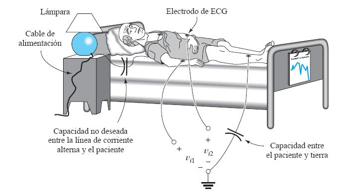 Ejemplo: Amplificador de ECG Los electrocardiógrafos deben amplificar señales