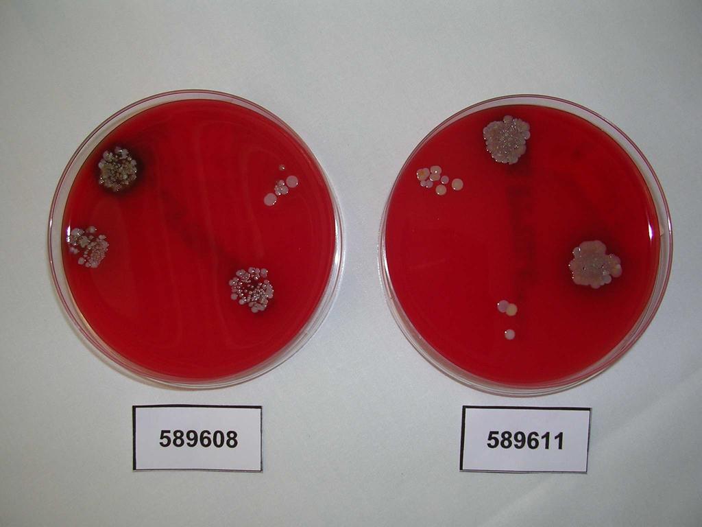 Improntas Lavado de manos con agua y jabón convencional 115 colonias de microorganismos 150 colonias de microorganismos