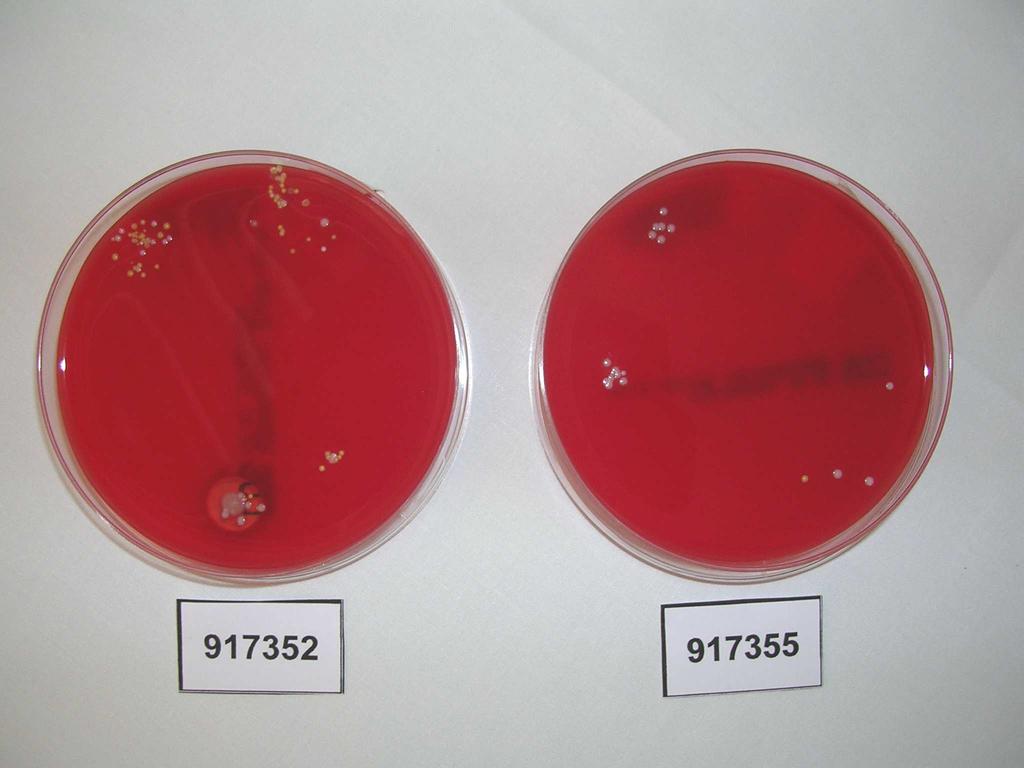 Improntas Lavado de manos con agua y jabón convencional 21 colonias de microorganismos 80 colonias de microorganismos
