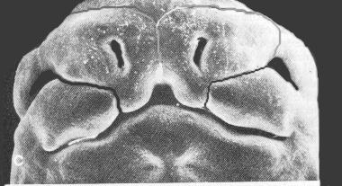 Micrografía Electrónica De Un Embrión De Siete Semanas Procesos