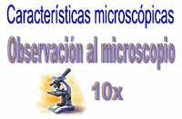La observación y evaluación de las características microscópicas en el fango activo tiene especial importancia en la