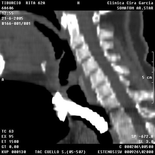 Imagenología. Radiografía de tórax AP y lateral.