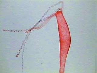 Phyllum Cnidarios (Cnidaria) Medusas: son