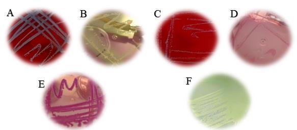 Figura 2: A) Colonias beta hemolíticas en gelosa sangre identificadas de S. aureus. B) S. aureus en agar Sal y Manitol, manitol positivo. C) Colonias alfa hemolíticas en gelosa sangre de S.