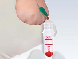 100/200 Extracción de sangre end-to-end