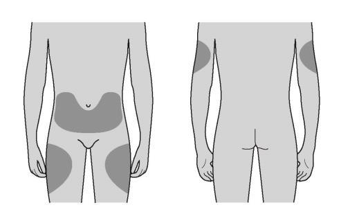 Dónde debe administrarse la inyección? Los mejores lugares para inyectarse son la parte superior de los muslos y el abdomen.