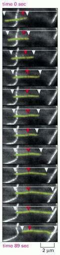 TREADMILLING E INESTABILIDAD DINAMICA EN EL MICROTUBULO DE UNA CELULA VIVA ------ (-) (+) Microtúbulos fluorescentes