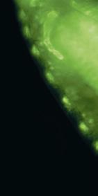 Imagen de larva de ephemera capturada