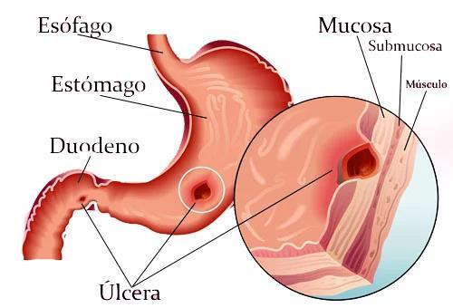 2.- Digestión Las células de la pared del estómago segregan el llamado jugo gástrico que contiene: Pepsina: enzima encargada de