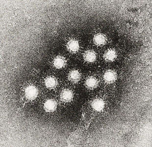 VIRUS A DE LA HEPATITIS FEINSTONE ET AL.