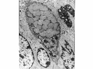 2.-Epitelio de glandular El epitelio glandular está constituido por células especializadas en la secreción, que pueden estar aisladas o agrupadas constituyendo las glándulas unicelulares o