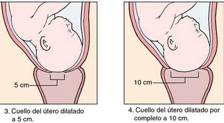 Período de tiempo comprendido entre el inicio del trabajo de parto, presencia de contracciones, hasta la dilatación completa del cuello uterino.