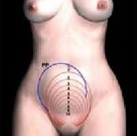 Realizar masajes de forma circular para extraer coágulos y favorecer involución uterina. 10.