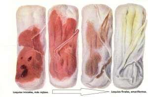 12. Realizar baño genital externo. 13. Evaluar características de loquios: color, olor, cantidad y evolución.