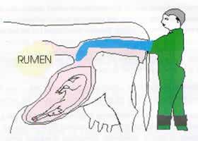 el feto en el útero, otras estructuras asociadas con la